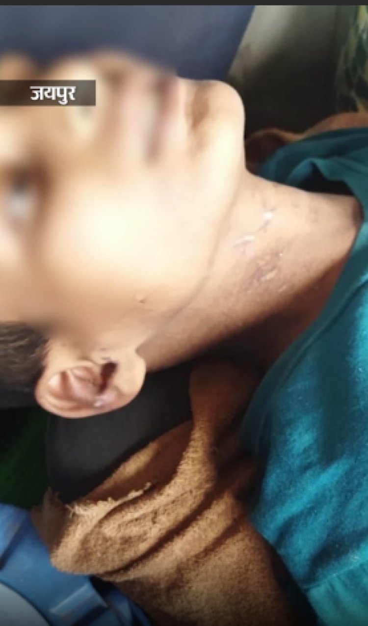 12 साल के बच्चे से हैवानियत, चाकू से काटे तलवे:पत्नी के सामने पति करता रहा नाबालिग से कुकर्म, रेंगता हुआ सड़क पर पहुंचा पीड़ित